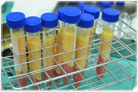 自体脂肪丰胸让我的小平胸变成大豪乳