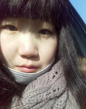 北京京美全切双眼皮加开眼角，眼睛又大又好看