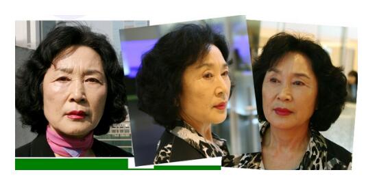 拉皮除皱手术让我年轻20岁