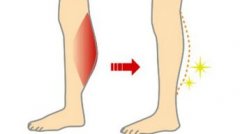 吸脂能让肌肉型小腿变细吗 肌肉型小腿怎么瘦？