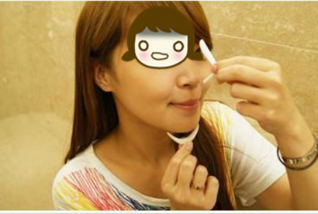 膨体隆鼻让我的颜值更上一层