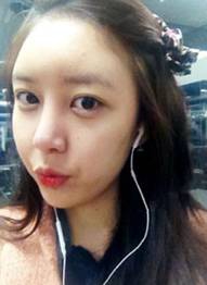 北京清木隆鼻整形后 **变身