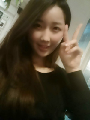 北京清木自体脂肪丰面颊2个月果分享