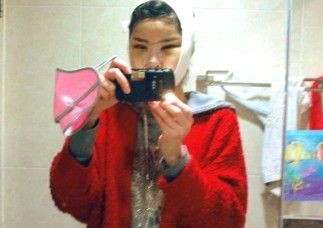 做了磨颧骨手术的我从小鸭子变成白天鹅 谢谢柳大烈教授