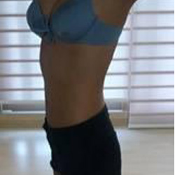 北京清木腰腹吸脂3个月感受