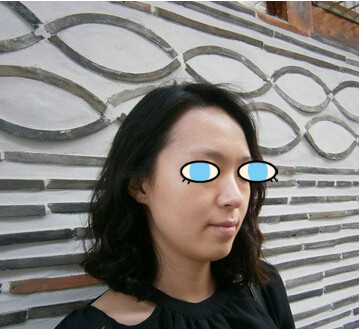 做了膨体隆鼻我也有了高鼻梁 **