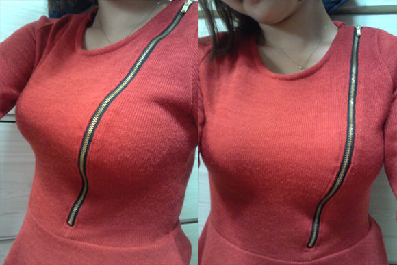 北京世熙自体脂肪隆胸,一下变到c罩杯