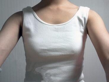 北京世熙自体脂肪隆胸2个月啦~