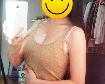 北京世熙自体脂肪隆胸2个月啦~