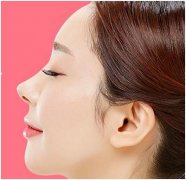 重庆驼峰鼻整形价格是多少 能保持多久时间