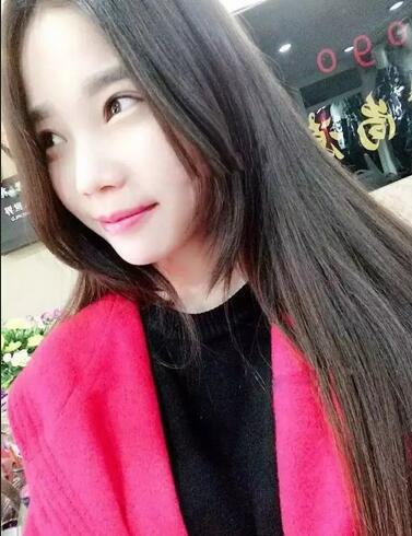 成都蜀尚蓉雅双眼皮恢复纪实 看看果怎么样