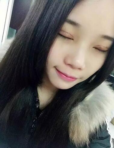 成都蜀尚蓉雅双眼皮恢复纪实 看看果怎么样