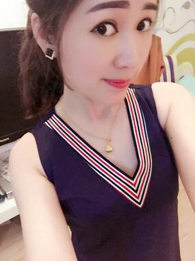 蜀尚蓉雅自体脂肪丰胸2个月啦~