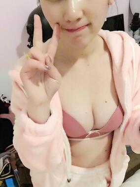 蜀尚蓉雅自体脂肪丰胸2个月啦~