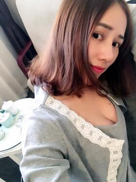 蜀尚蓉雅自体脂肪丰胸2个月啦~