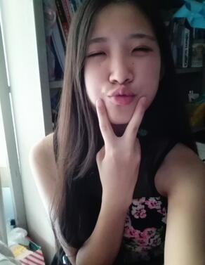 双眼皮15天恢复记录