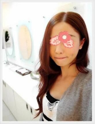 埋埋蛋白线.提升拯救了我的大小脸和皮肤下垂