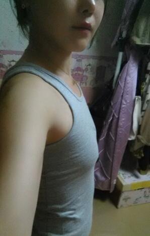 成都艾米丽自体脂肪隆胸三个月啦~