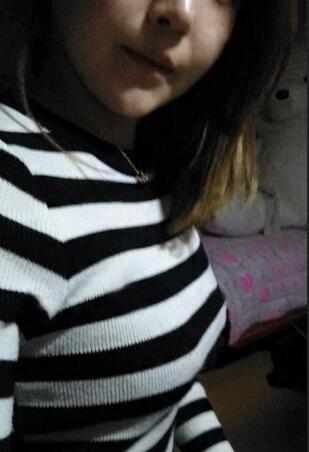 成都艾米丽自体脂肪隆胸三个月啦~