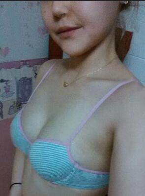 成都艾米丽自体脂肪隆胸三个月啦~