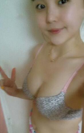 成都艾米丽自体脂肪隆胸三个月啦~