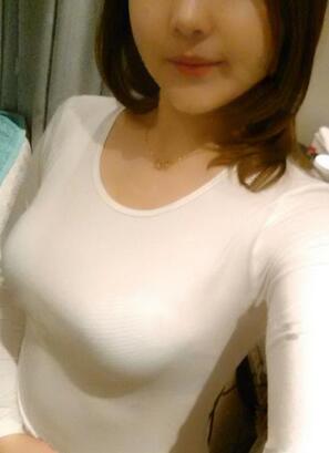 成都艾米丽自体脂肪隆胸三个月啦~