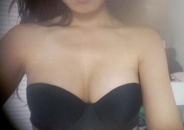 成都艾米丽自体脂肪丰胸前后对比