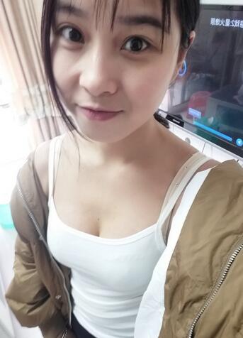 成都艾米丽自体脂肪丰胸前后对比