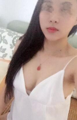 艾米丽自体脂肪隆胸恢复经历