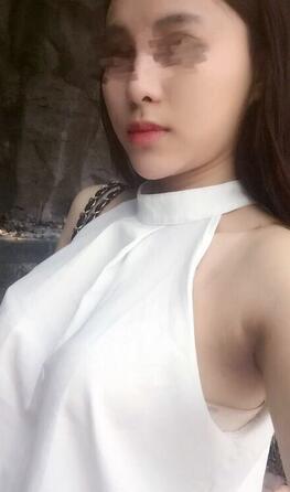 艾米丽自体脂肪隆胸恢复经历