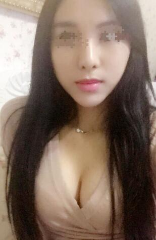 艾米丽自体脂肪隆胸恢复经历