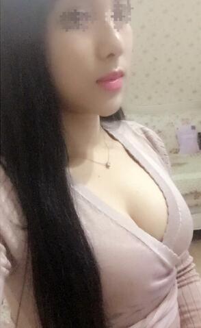 艾米丽自体脂肪隆胸恢复经历