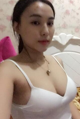 艾米丽自体脂肪隆胸恢复经历