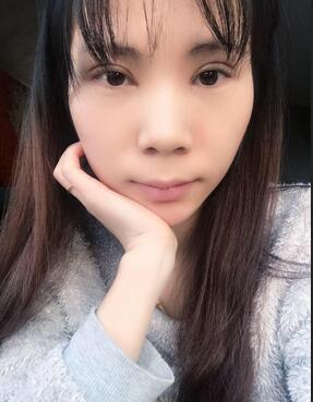 长沙美之峰重睑+开眼角恢复过程图