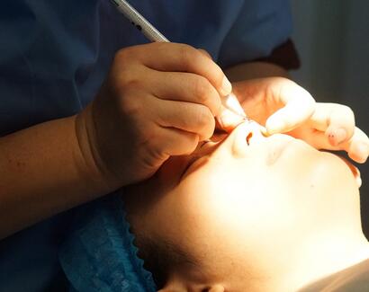 长沙美之峰假体隆鼻恢复日记