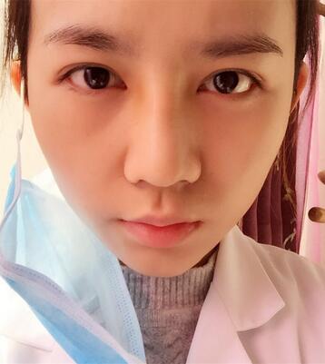 长沙美之峰假体隆鼻恢复日记