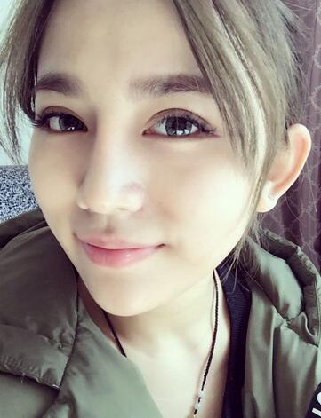 长沙美之峰假体隆鼻恢复日记