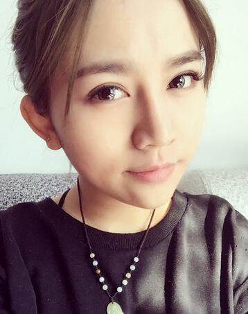 长沙美之峰假体隆鼻恢复日记