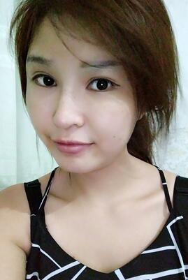 长沙美之峰隆鼻整形手术恢复日记图