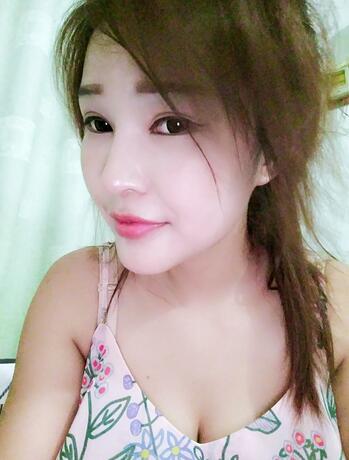 长沙美之峰隆鼻整形手术恢复日记图