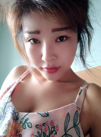 长沙美之峰隆鼻整形手术恢复日记图