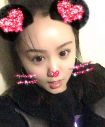 石家庄蓝山欧式芭比双眼皮经历