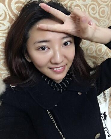 北京欧华去痘坑痘印两个月