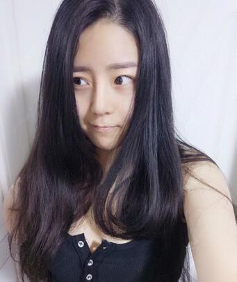 隆鼻整形手术一个月恢复日记