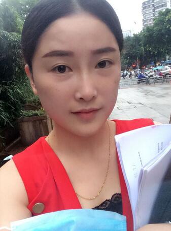 爱悦丽格玻尿酸丰苹果肌、丰下巴、隆鼻