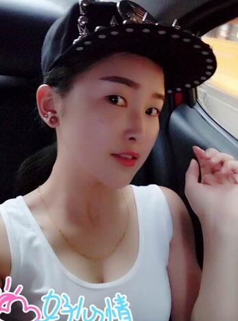 爱悦丽格玻尿酸丰苹果肌、丰下巴、隆鼻