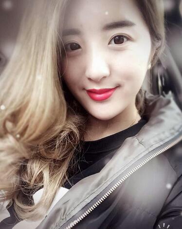 爱悦丽格玻尿酸丰脸颊日记分享