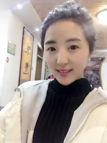 爱悦丽格玻尿酸丰脸颊日记分享