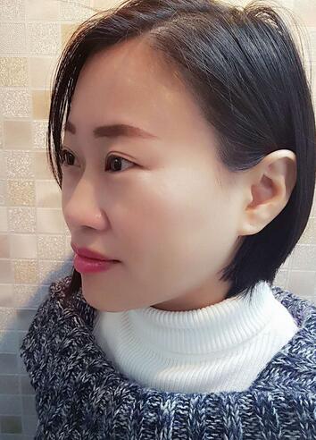 武汉中爱注射瘦脸去鱼尾纹一个月