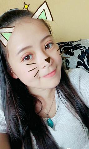 梨花雨割双眼皮恢复半年了